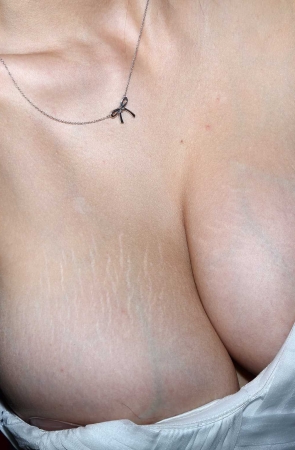 小乳牛